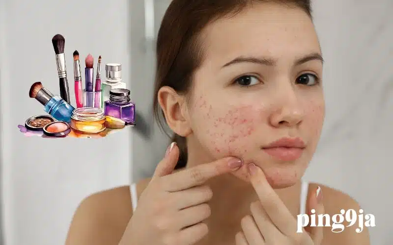 Makeup for Mature Acne Prone Skin